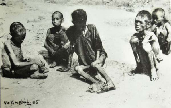 Hình ảnh tư liệu: Những người còn sống trong nạn đói, với những cơ thể chỉ còn da bọc xương